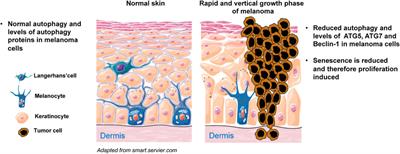 Autophagy and Skin Diseases